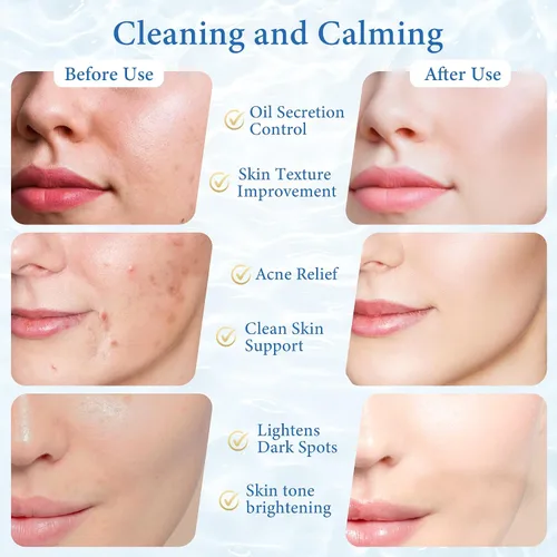 Vista 4 de Almohadillas de tóner exfoliantes para cara y cuerpo, suaves para pieles sensibles, 1% ácido salicílico, limpieza y suavización de poros, con cica