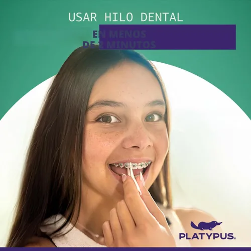 Vista 5 de Platypus Hilo dental ortodóntico para brackets, 30 unidades (paquete de 1), palillos ortodónticos para adultos y niños, se adapta debajo del alambre