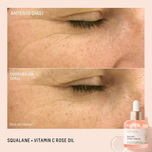 Vista 2 de BIOSSANCE Squalane + Vitamin C Rose Advanced Facial Oil - Brightening, Firming, and Hydrating Serum for All Skin Types - Chios Crystal Oil, Damascus
