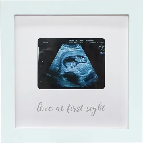 Vista 10 de Sonogram - Marco de fotos para abuela, marco de fotos de ultrasonido, anuncio de embarazo para abuela, ideas de anuncio de bebé, marco de fotos