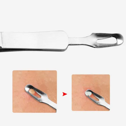 Vista 9 de Precisión de precisión de precisión 3 unids espinilla curvada punta de acero Comedone Splinter Extractor herramienta herramienta herramienta