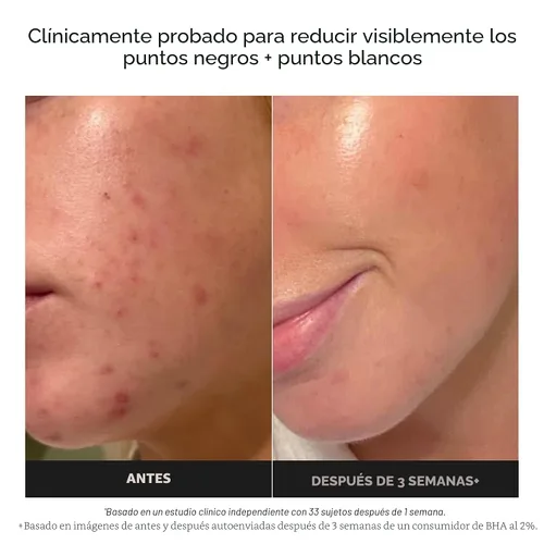Vista 3 de Paula's Choice SKIN PERFECTING 2% BHA Liquid Exfoliant with Salicylic Acid, Facial Polish for Pores, Wrinkles & Fine Lines, Suitable for