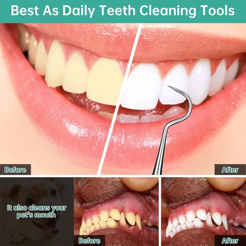 Vista 5 de Herramienta raspadora dental profesional, púa de dentista, paquete de 3 unidades de acero inoxidable médico, raspador de tarter dental