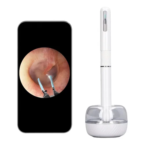 Vista 5 de Limpiador inteligente de oídos visible, eliminación de cera de oídos, herramienta de eliminación de cera de oídos, 10MP HD 360 grados gran angular