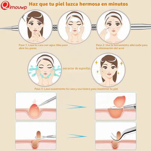 Vista 5 de Kit de herramientas de 16 piezas, herramientas para eliminar puntos negros, extractor de comedones, kit de eliminación de acné y quiste