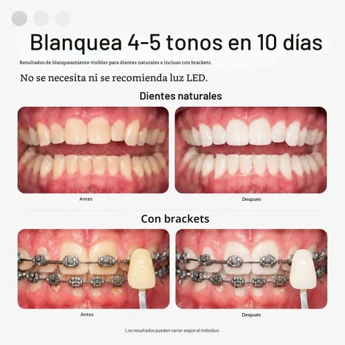 Vista 4 de Opalescence Go 4648-1 - Bandejas blanqueadoras dentales con peróxido
