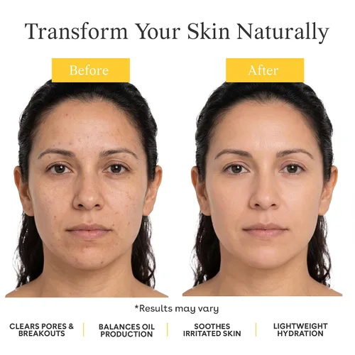 Vista 3 de Suki Loción de día purificadora y equilibrante para el cuidado de la piel con ácido salicílico, hidratante facial hidratante y antienvejecimiento