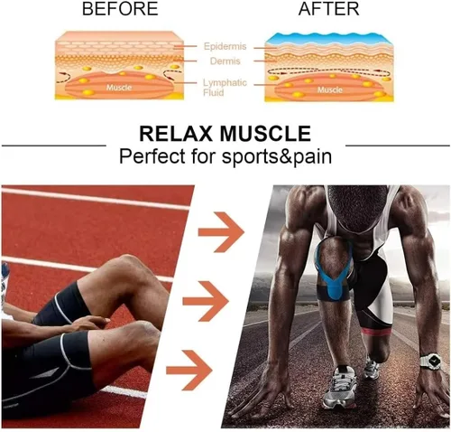 Vista 3 de Deilin Cinta de kinesiología, cintas deportivas terapéuticas elásticas para rodilla, hombro y codo, cinta corporal para levantar y levantar, Beige