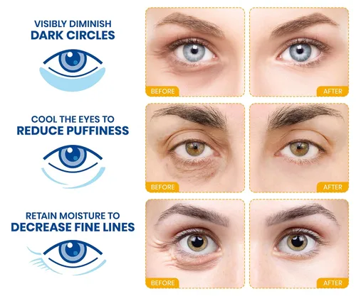 Vista 2 de Stylia Parches para usar debajo de los ojos para ojos hinchados y ojeras (20 pares) – Mascarilla de oro de 24 quilates para usar debajo de los ojos