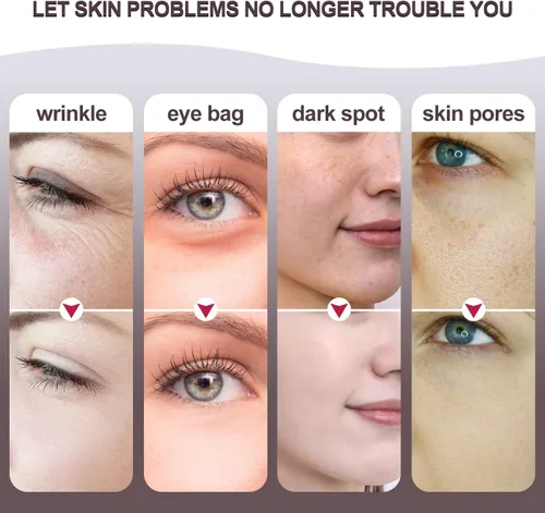 Vista 6 de Máquinas faciales de alta frecuencia, 4 en 1 dispositivo facial de la fotontherapy de la luz de la microcorriente del Massager para la cara