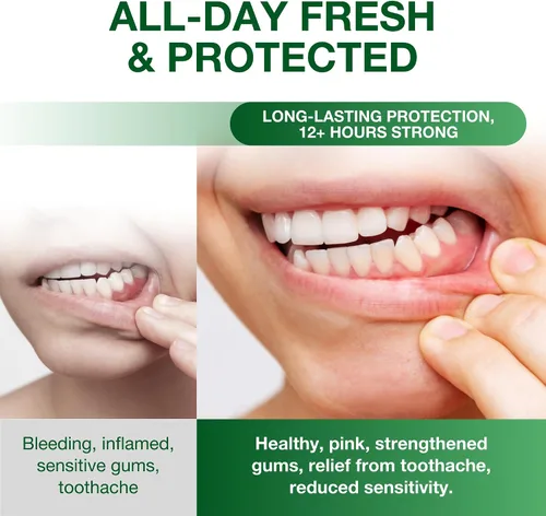 Vista 7 de Sri Sri Tattva Sudanta - Pasta de dientes de carbón - SLS, pasta de dientes herbales sin flúor con neem y hierbas ayurvédicas, blanqueamiento dental