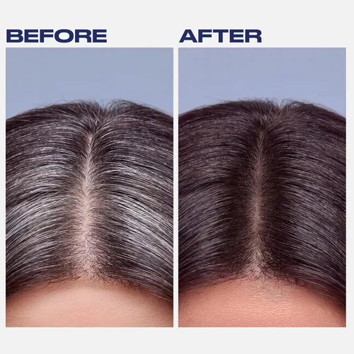 Vista 5 de Clairol Spray para colorear el cabello para retoque de raíz, marrón oscuro