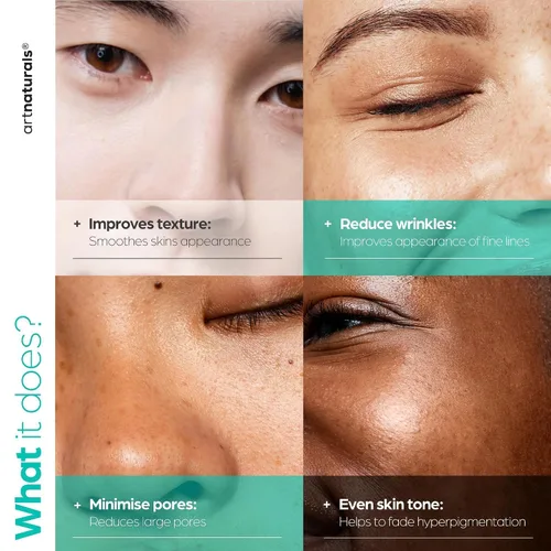 Vista 5 de ArtNaturals - Suero facial de 10% niacinamida activa con 1% de zinc PCA y vitamina B3, fórmula avanzada ácido hialurónico, reductor de poros