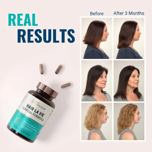 Vista 3 de Hair La Vie Live Conscious - Vitaminas clínicas para el crecimiento del cabello para mujeres y hombres con biotina, colágeno y palma enana americana