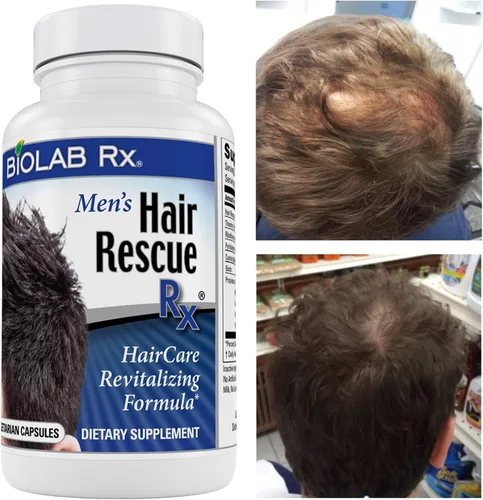 Vista 8 de Hair Rescue Rx - Suplemento para adelgazar el cabello para hombre con biotina y ortiga, soporta un cabello más grueso y saludable, soporte