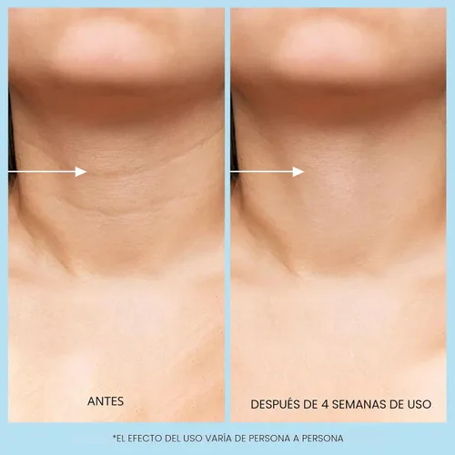 Vista 5 de UJhay Crema de Cuello con Retinol, Crema Reafirmante Enriquecida con Ácido Hialurónico y Cafeína para Minimizar Líneas Finas y Opacidad - Crema
