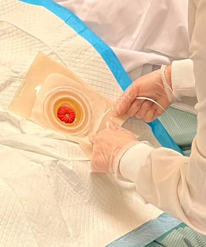 Vista 2 de Set de práctica de cuidado de ostomía