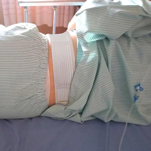 Vista 6 de EXCEART Gastrostomía Tubos de ocultamiento Gastrostomía Tubos Cinturón Abdominal Alimentación Tubos de Diálisis Catéter Cinturón Tamaño S