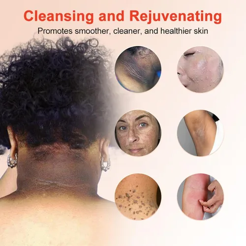 Vista 3 de Gel exfoliante purificador, limpiador facial y exfoliante de limpieza profunda para rostro y cuerpo, hidratante limpia la piel y limpia la suciedad
