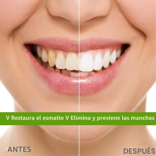 Vista 7 de Rembrandt Deeply White + Pasta de dientes blanqueadora de peróxido, sabor a menta, 3.5 onzas (paquete de 2) (el embalaje puede variar)