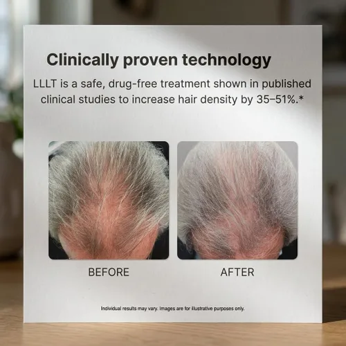 Vista 4 de Alpha Hair Growth Laser Cap (136 láseres) Dispositivo de crecimiento láser aprobado por la FDA para hombres y mujeres, tecnología láser SMT, salida