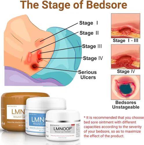 Vista 3 de Crema para el dolor de cama, ungüento orgánico para úlceras por decúbito, tratamiento de úlceras por presión, curación rápida de heridas