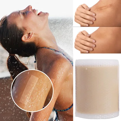 Vista 4 de Láminas de silicona anchas impermeables para reparación de la piel, cubierta autoadhesiva, tatuajes, cicatrices, calcomanías para el cuidado