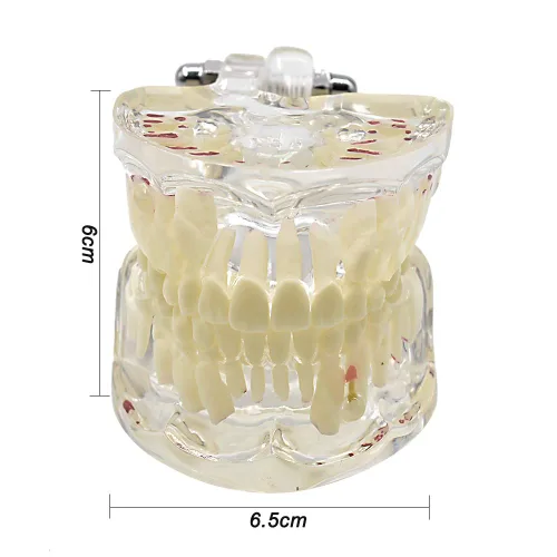 Vista 2 de Modelo de dientes para niños,Modelo de dientes de demostración dental transparente,Modelo de enseñanza de Typodont