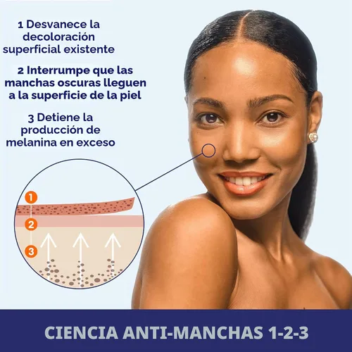 Vista 6 de Palmer's Skin Success Crema Antimanchas Desvanecedora para Piel Seca, 4.4 Onzas Helps Reduce Dark Spots and Age Spots, Evens Skin Tone & Balances
