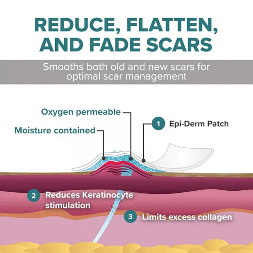 Vista 4 de EpiDerm - Hojas pequeñas de silicona para cicatrices, reutilizables, 2 x 2.5 pulgadas, 1 par, natural Soft Flexible Silicone Scar Patches for
