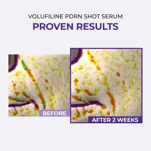 Vista 6 de DOMINAS AtClinic Volufiline PDRN Serum - 2 semanas de volumen y elasticidad potenciador con 5% de volufilina, PDRN y paeonol, pérdida de volumen