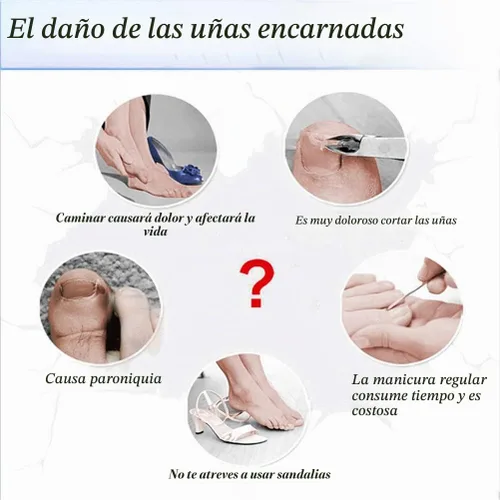 Vista 7 de Parche de corrección de uñas encarnadas, 50 calcomanías de uñas encarnadas sin pegamento para uñas encarnadas curvadas para el cuidado de los pies