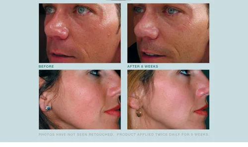 Vista 4 de Crema facial antienvejecimiento, triple antioxidante, suero de tratamiento para cara, resveratrol + té verde + cafeína, reduce visiblemente