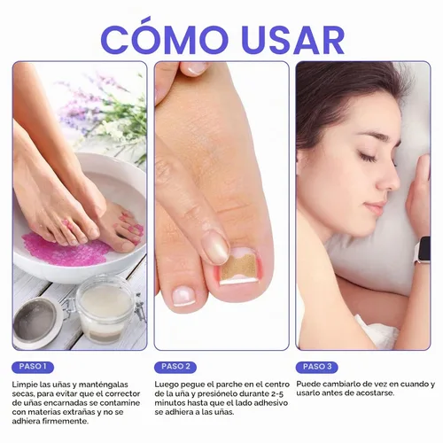 Vista 7 de Parche corrector de uñas encarnadas, 100 tiras correctoras de uñas encarnadas, parches de corrección de uñas de los pies, herramienta de tratamiento