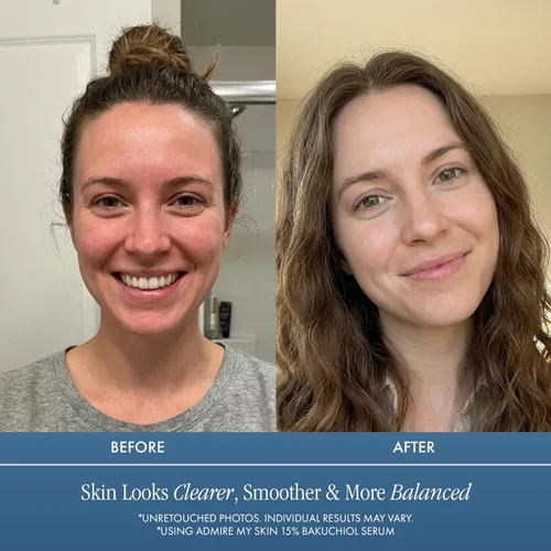 Vista 5 de Admire My Skin Suero Bakuchiol, alternativa natural de suero de retinol para la cara, suero facial antimanchas antienvejecimiento contiene aloe