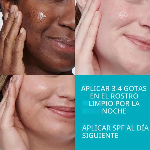 Vista 5 de La Roche-Posay Effaclar - Suero de ácido salicílico al 1,5%, tratamiento para el acné para la cara con ácido glicólico y niacinamida, suero