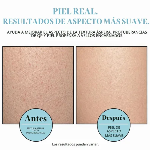 Vista 6 de BASE LABORATORIES Exfoliante corporal para cabello encarnado y KP con AHA