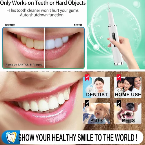 Vista 2 de Removedor de placa profesional para dientes, herramienta inteligente de limpieza de dientes activada por contacto