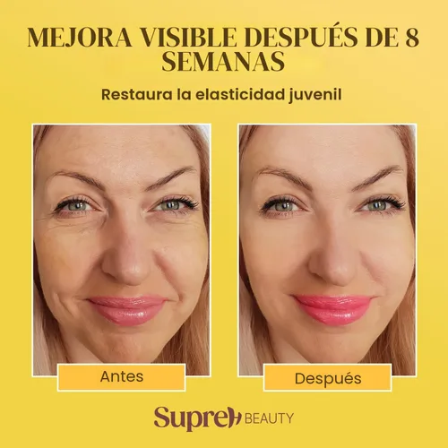 Vista 7 de SupreH Bee Venom Cream Wrinkle Filler: Crema de estiramiento facial instantáneo y crema tensora de ojos con ácido hialurónico niacinamida