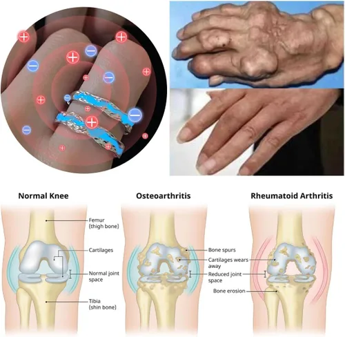 Vista 2 de Anillo luminoso de magterapia linfática para hombres y mujeres, terapia de iones de titanio, acupuntura, desatasca, ganglios linfáticos del torrente