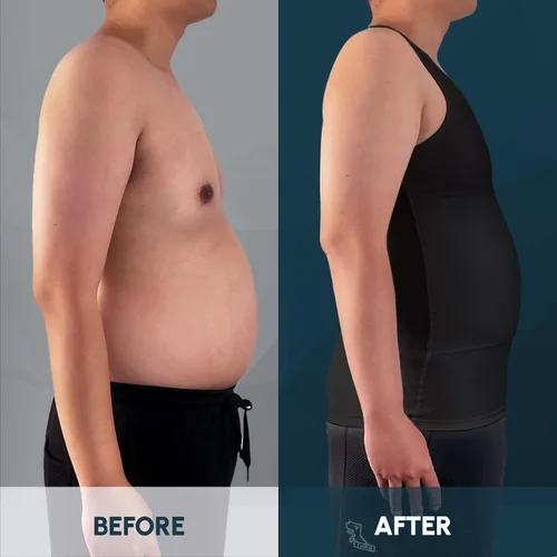 Vista 3 de Aptoco Camisas de compresión para hombre, chaleco para hombre de ginecomastia
