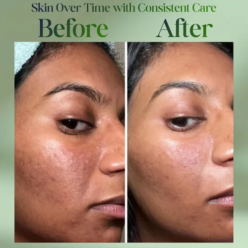 Vista 5 de Crema de colágeno, retinol y ácido hialurónico – Hidratante diario antienvejecimiento para cara y cuello, crema reafirmante, ligera, de rápida