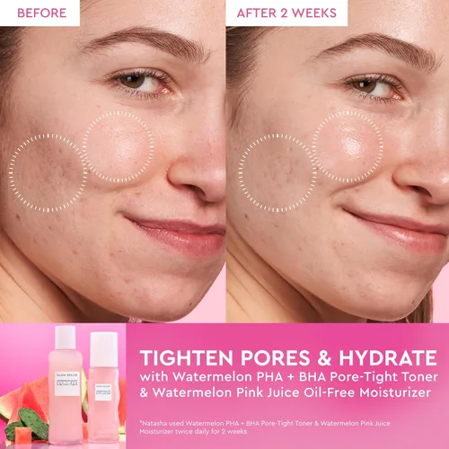 Vista 4 de Glow Recipe Pink Juice - Gel Hidratante Facial de Agua para mujeres, hombres y adolescentes, tamaño de viaje, ácido hialurónico hidratante