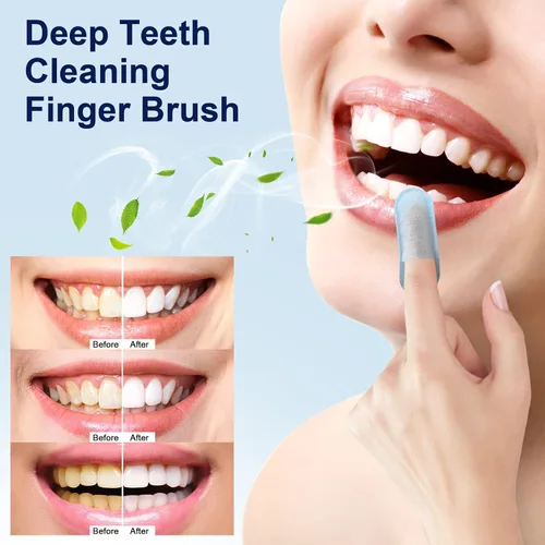 Vista 4 de MySmile 100 piezas de toallitas de dientes, cepillo de dedos de limpieza profunda, cepillo oral para limpieza de dientes, sabor a menta
