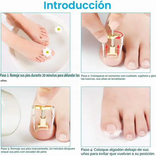 Vista 5 de 2 piezas encarnadas levantador de uñas encarnadas herramienta de uñas encarnadas abrazadera del dedo del pie de acero inoxidable herramienta