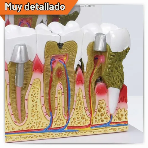 Vista 2 de GPI Anatomicals Modelo de anatomía de dientes humanos con problemas