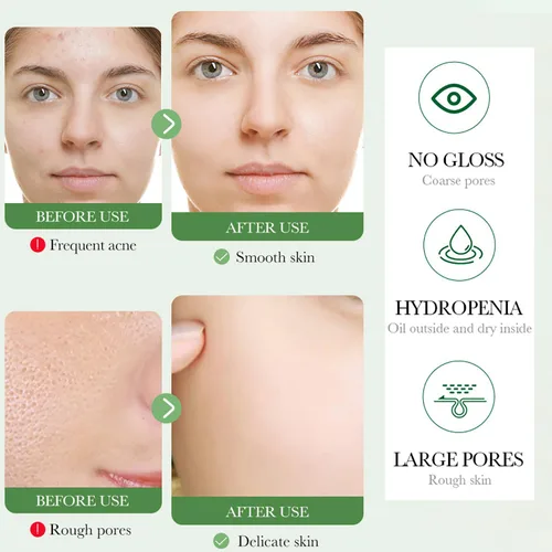 Vista 6 de BIOAQUA Centella Asiatica Limpiador Facial Calmante Control de Aceite Anti-Acné Profundo Pore Limpio Facial Hidratante Hidratante 100g/3.5oz