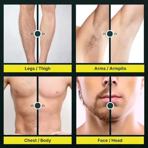 Vista 6 de Upkeeper - Recortadora de pelo corporal y peluquera para hombres