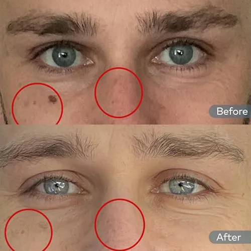 Vista 3 de Onekind Hidratante de noche para rostro, crema hidratante de ensueño para arrugas, crema de noche para mujeres antienvejecimiento con escualano