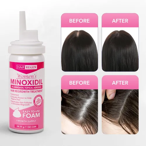 Vista 9 de Hair Regen Minoxidil Foam para mujeres 5% - Tratamiento de crecimiento del cabello para mujer - Minoxidil espumoso tópico para mujeres - Ideal